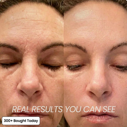 ✨LAST DAY 60% OFF  Korean Pink Collagen Volume Multi Balm